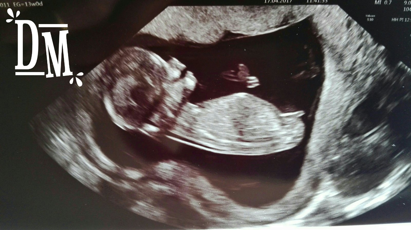 ¡Bebé arco iris en camino!, ¡llega nuestro cuarto hijo!